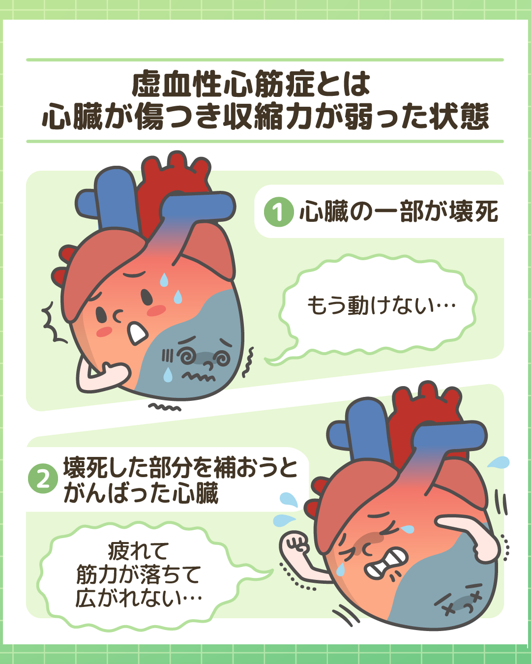 虚血性心筋症によって心臓の収縮力が低下する仕組みの解説図