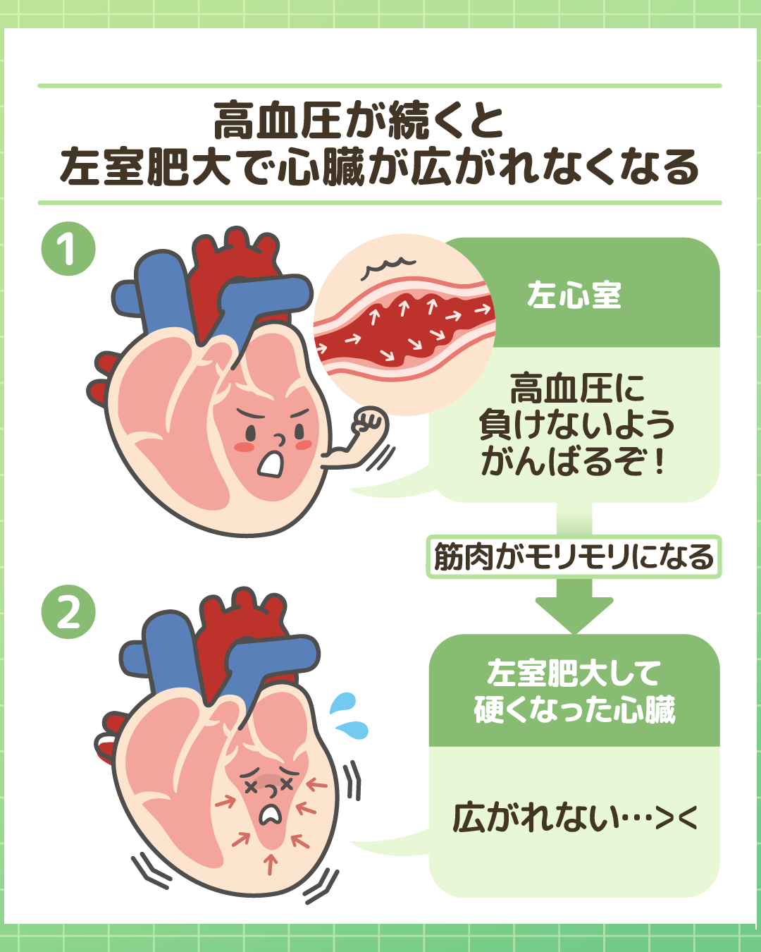 高血圧が原因で左室肥大が起こり心臓が広がりにくくなるプロセスの図解