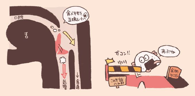 嚥下時の喉頭蓋の働きを解説するイラスト。左側の断面図では、口腔から入った食べ物が食道へと流れる際、ピンク色の喉頭蓋が倒れて気管の入り口をふさぎ、「食べ物を正規ルートへ」導く様子が描かれています。右側にはその仕組みを擬人化したイラストがあり、おにぎりのキャラクターが通る際に、遮断機のような喉頭蓋が「ガコン!!」と閉まって気管(この先気道のみ!!)への進入を防ぎ、「食物はこちら」という旗の方へ誘導する様子がコミカルに描かれています。