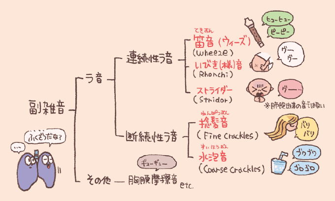 副雑音の種類を分類した系統図。副雑音は「ラ音」と「その他(胸膜摩擦音など)」に分かれ、ラ音はさらに「連続性ラ音」と「断続性ラ音」に分類されています。連続性ラ音には、笛音(ウィーズ/wheeze、ヒューヒュー・ピーピー)、いびき(様)音(Rhonchi、グーグー)、ストライダー(Stridor、グー… ※肺胞由来ではない)が含まれます。断続性ラ音には、捻髪音(Fine Crackles、パリパリ)、水泡音(Coarse Crackles、ブクブク・ゴロゴロ)が含まれます。それぞれの音のイメージとして、リコーダーやいびきをかく人、炭酸飲料などのイラストが添えられています。
