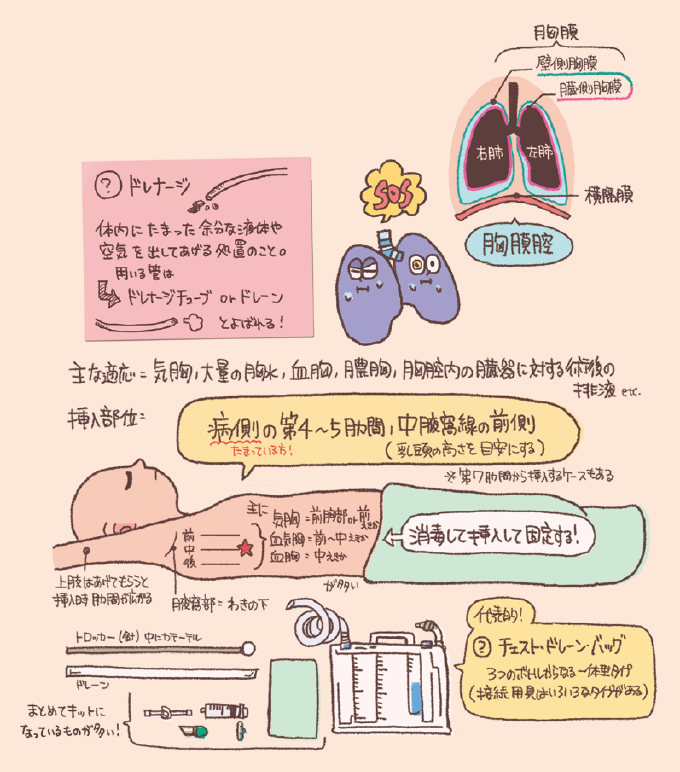 胸腔ドレナージの概要と手順を説明するイラスト図解。上部には「胸膜腔(壁側胸膜と臓側胸膜の間)」の構造と、ドレナージが体内の余分な液体や空気を取り出す処置であることを説明するメモがあります。主な適応として気胸、大量の胸水、血胸、膿胸、術後排液などが挙げられています。挿入部位は「病側の第4〜5肋間、中腋窩線の前側(乳頭の高さを目安)」とし、気胸なら前寄り、血胸なら中寄りといった詳細も記載。下部にはトロッカー、ドレーン、チェスト・ドレーン・バッグなどの必要物品がイラストで紹介されています。