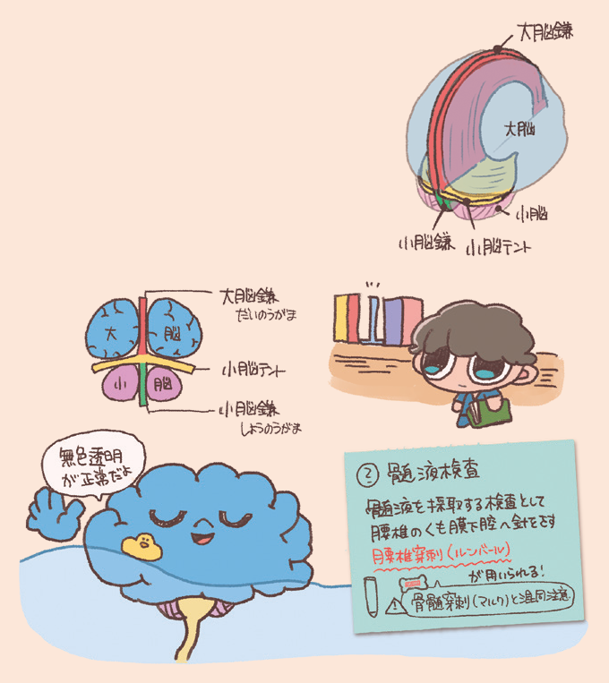 硬膜の特殊な形態と髄液検査について説明するイラスト図解。硬膜の形態: 左右の大脳半球の間に垂れ下がる「大脳鎌(だいのうがま)」、大脳と小脳を仕切る「小脳テント」、小脳の間に位置する「小脳鎌(しょうのうがま)」といった、硬膜が脳の隙間に入り込んで作った構造が示されています。髄液検査(ルンバール): 髄液を採取するために腰椎のくも膜下腔へ針を刺す「腰椎穿刺(ようついせんし)」について解説されています。正常な髄液は「無色透明」であることや、「骨髄穿刺(マルク)」との混同に注意するようポイントが記されています。