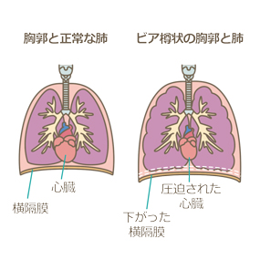 肺 イラスト 看護 無料画像壁紙ahd
