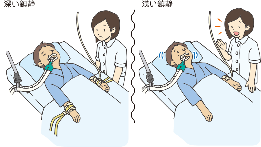 鎮静し過ぎると何がいけない 看護roo カンゴルー