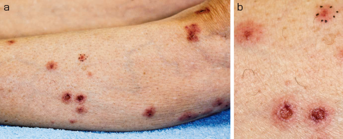  UC は MS とどのような関係がありますか?