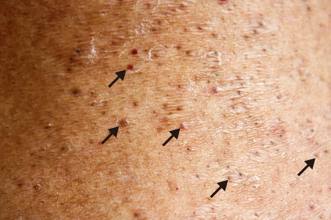 症状を和らげる最良の方法