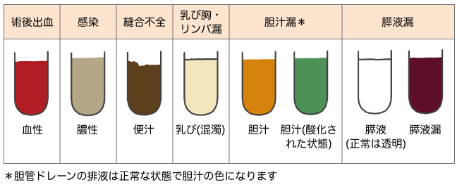 胆道ドレナージに関するよくある質問