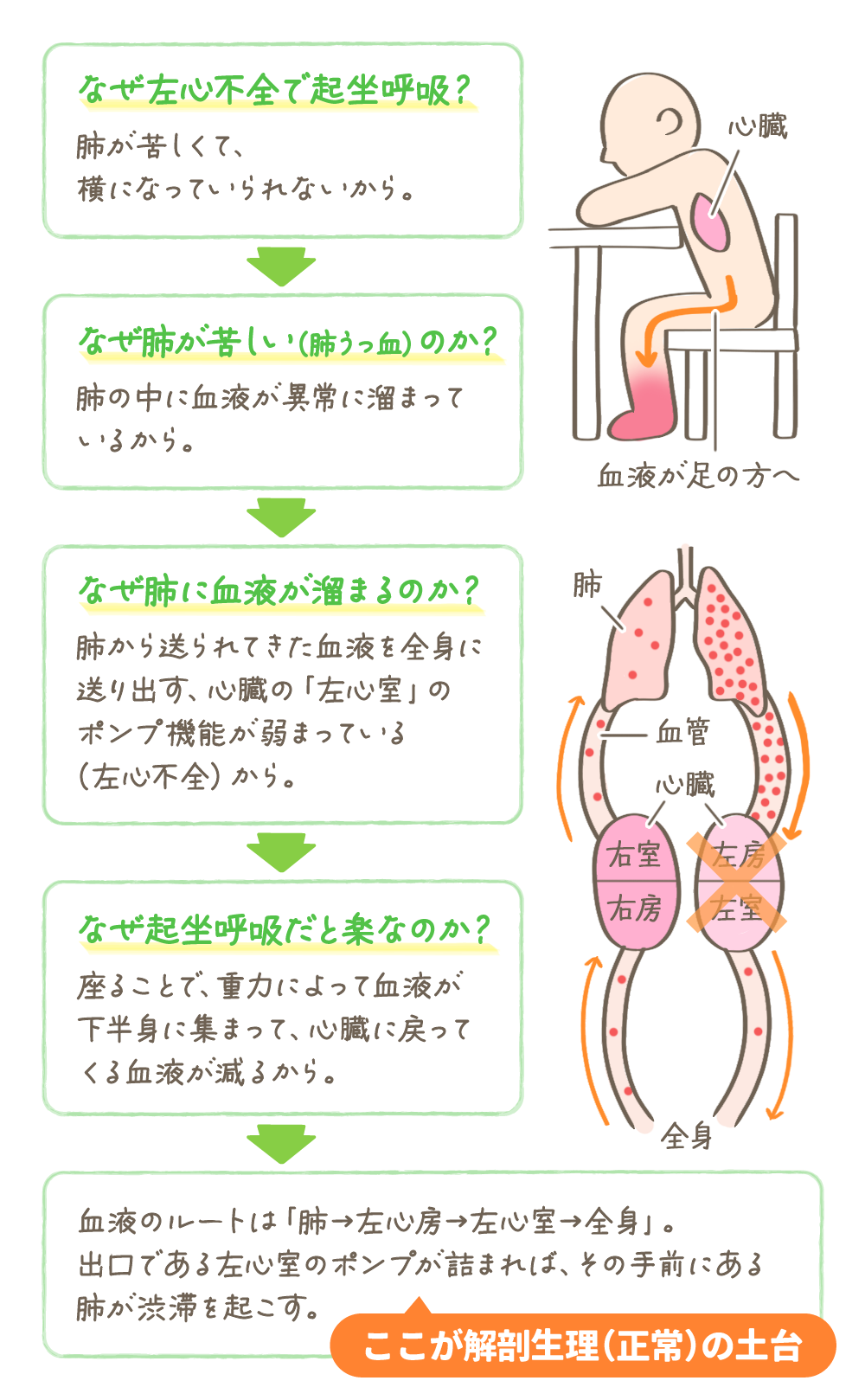 左心不全から起坐呼吸、肺うっ血、左心室ポンプ機能低下、解剖生理への掘り下げ図