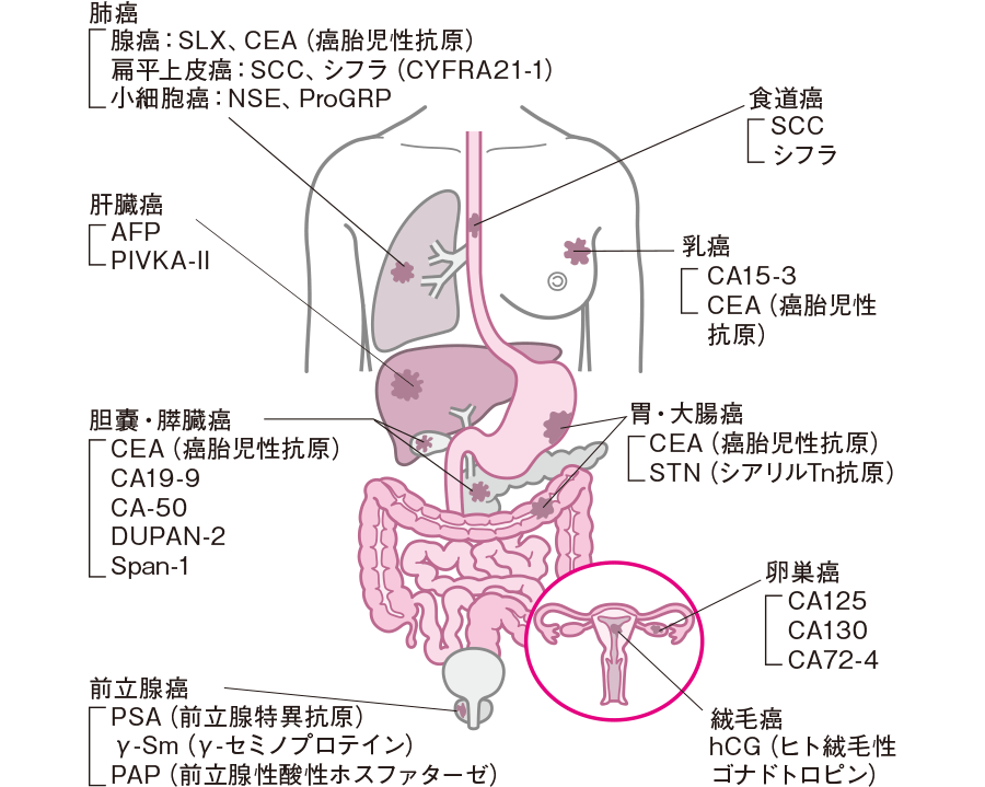 転移性胃がんはどのように治療されますか?
