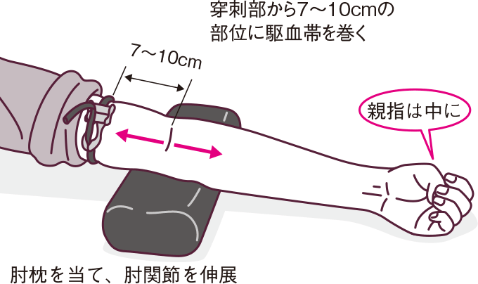 駆血帯の巻き方とゴム管の端の向き