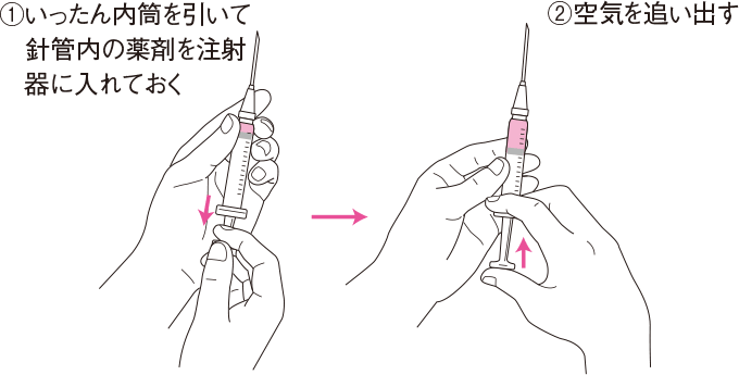 注射筒の空気の抜き方