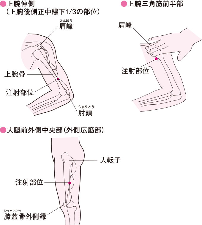 皮下注射に適した部位