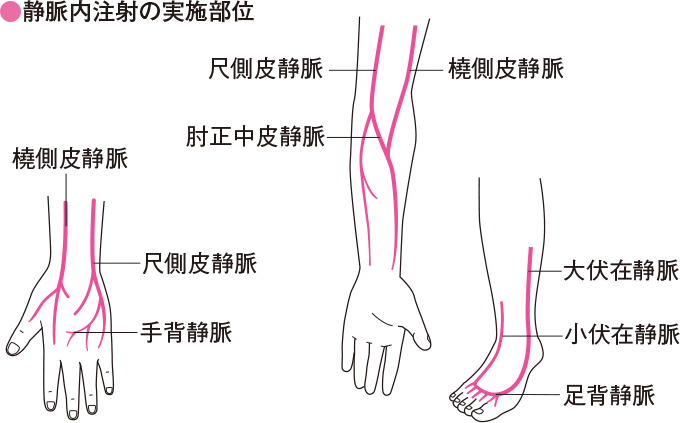 静脈内注射の実施部位