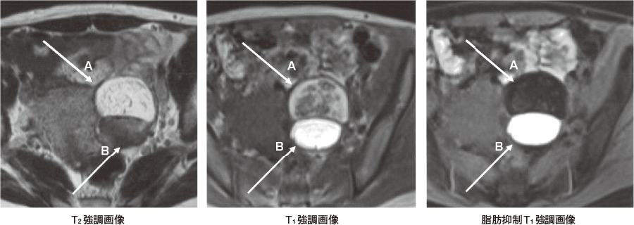 医師に連絡する時期