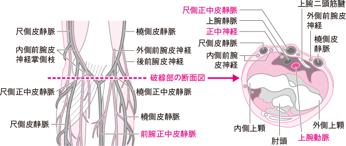採血しやすい皮静脈