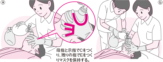 バッグバブルマスクによる人工呼吸