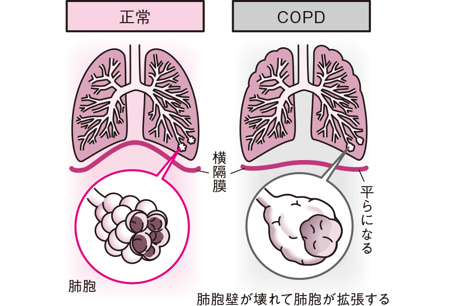 治療法はありますか？