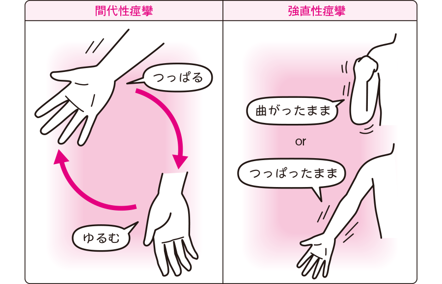 局所発作の治療法は何ですか?