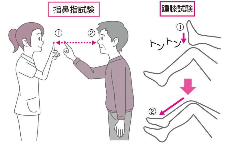 指鼻指試験、踵膝試験