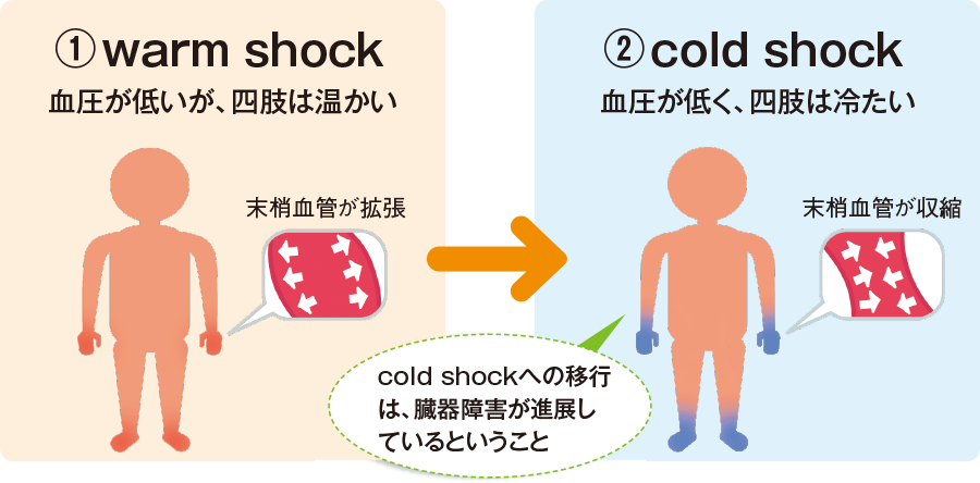敗血症性ショック後