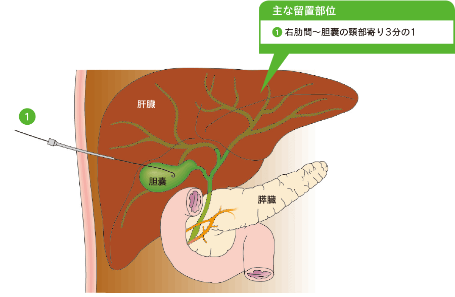 潜在的なリスクと副作用