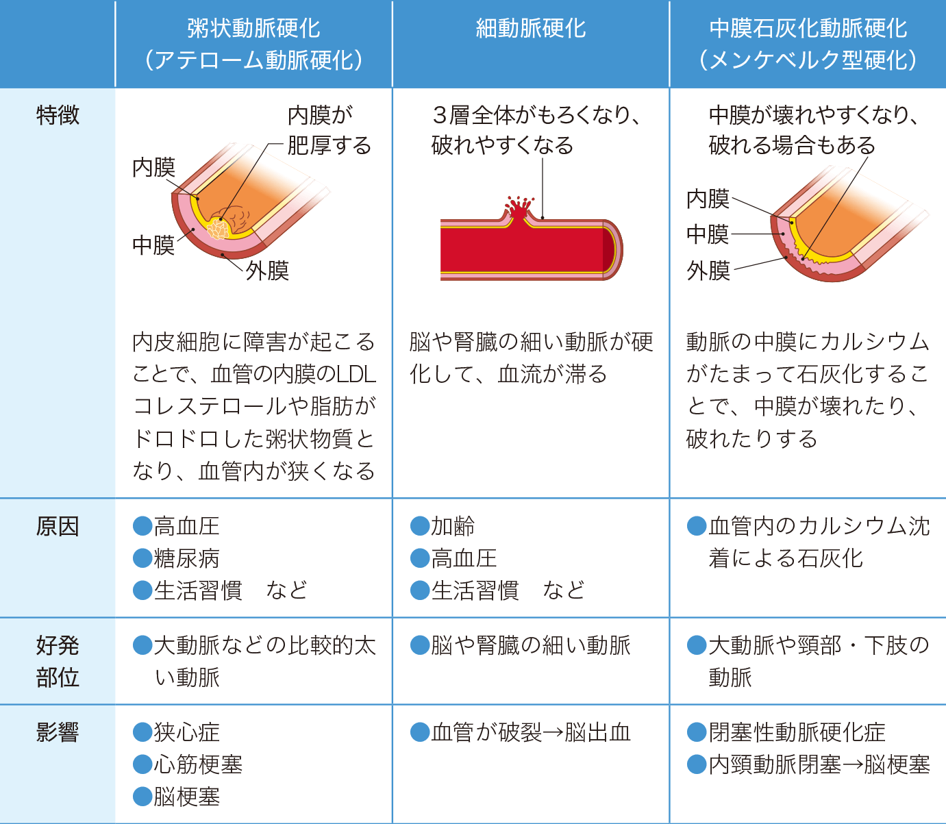 動脈硬化の分類