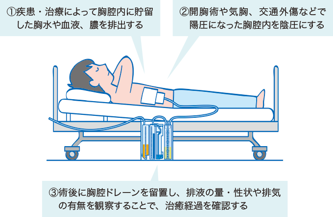 いつ医師の助けを求めるべきか