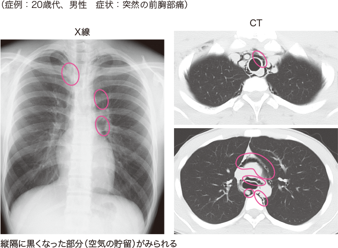 それは何ですか？