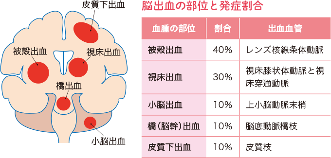 出血性疾患はどのように診断されますか?